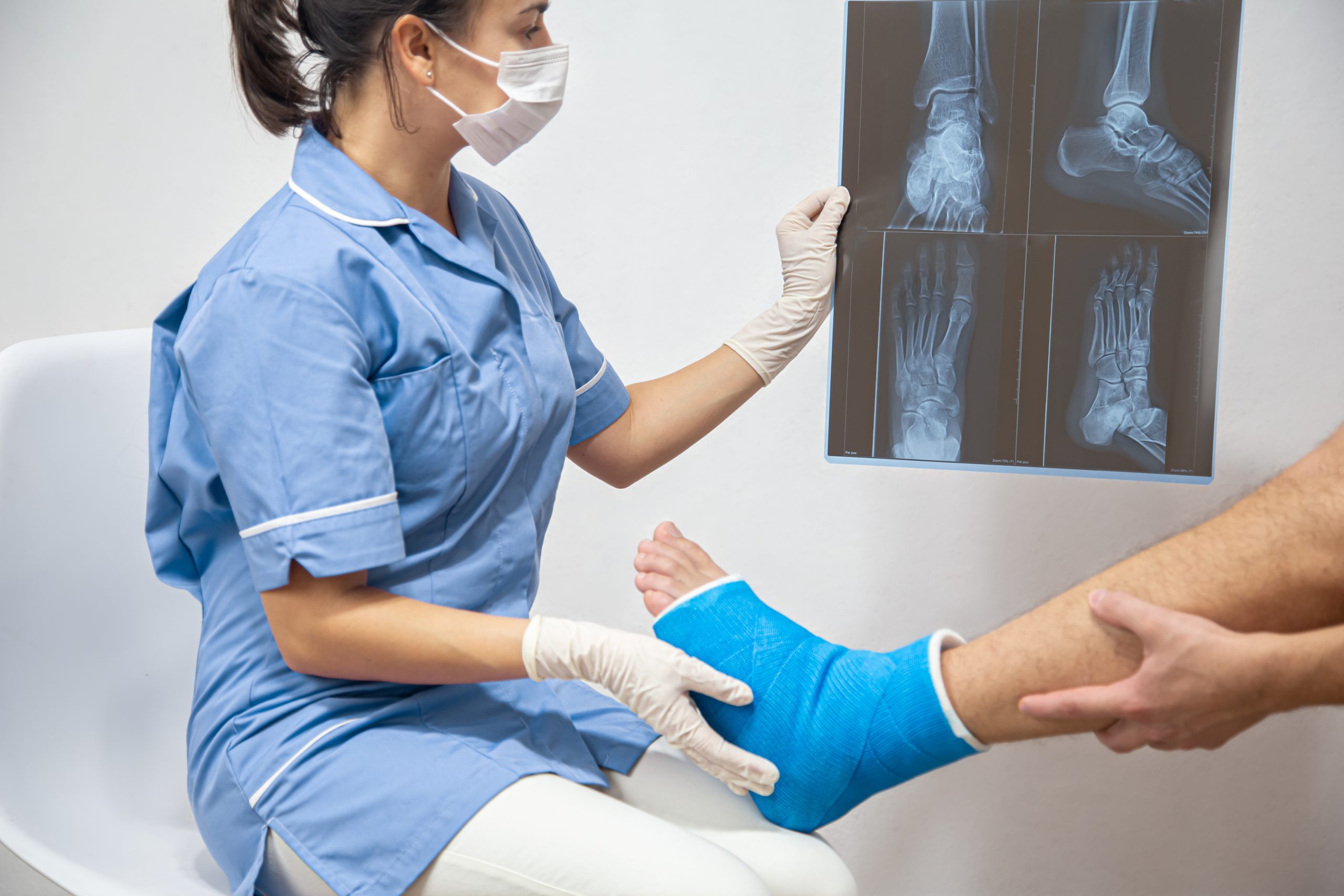 Broken bone orthopedic urgent care